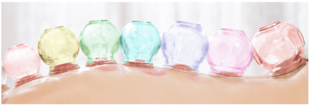ventouses en verres colorés
application de ventouse sur le dos
ventousothérapie
soins avec les ventouses